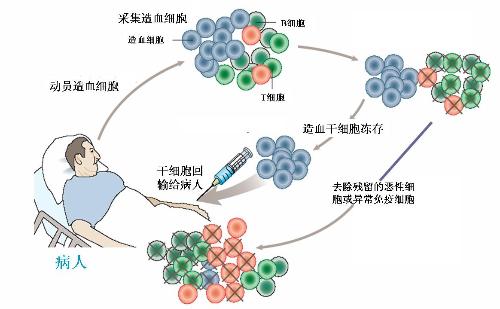 造血干细胞移植1.jpg