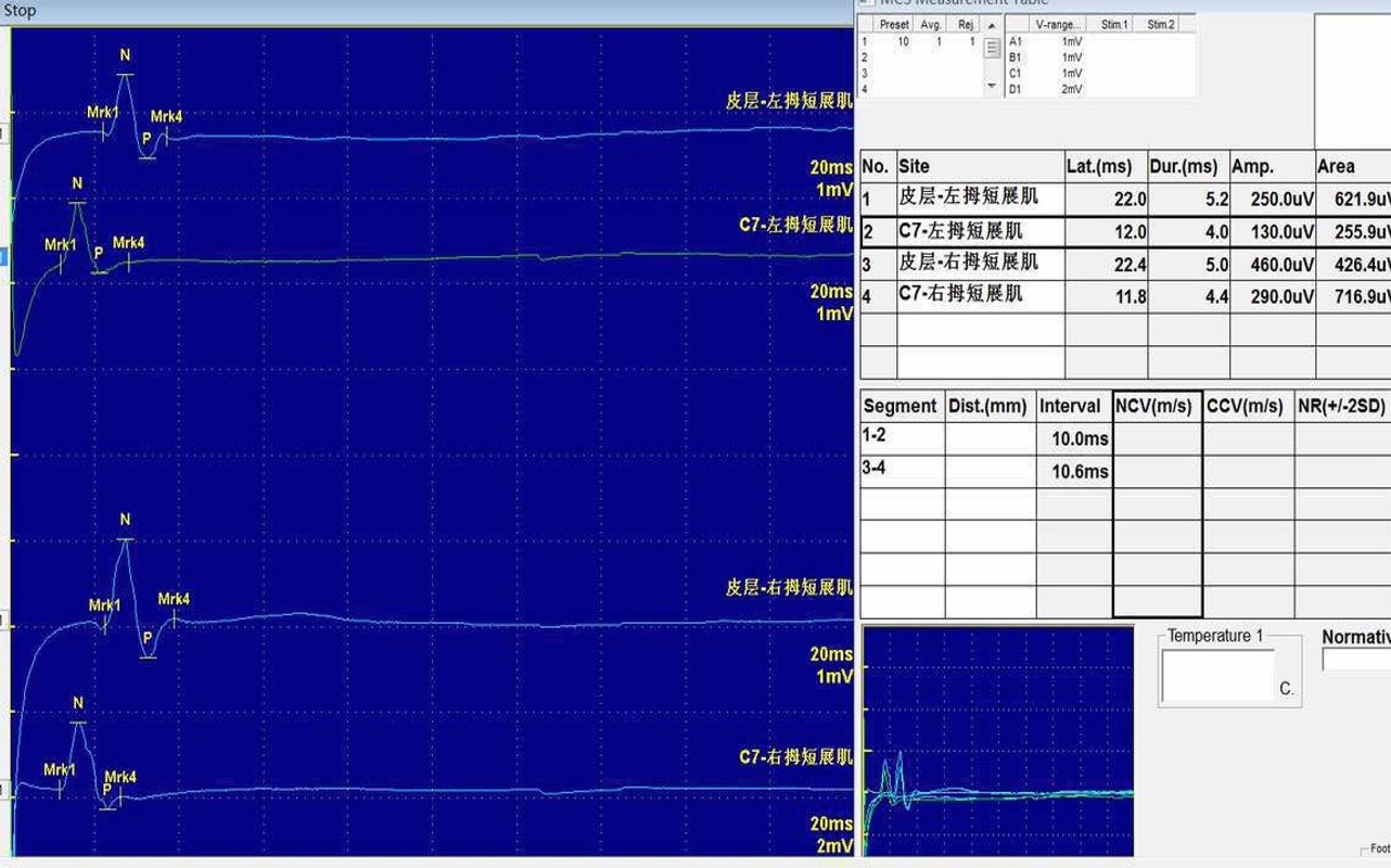 KF0402运动诱发电位的原理与检测方法.jpg