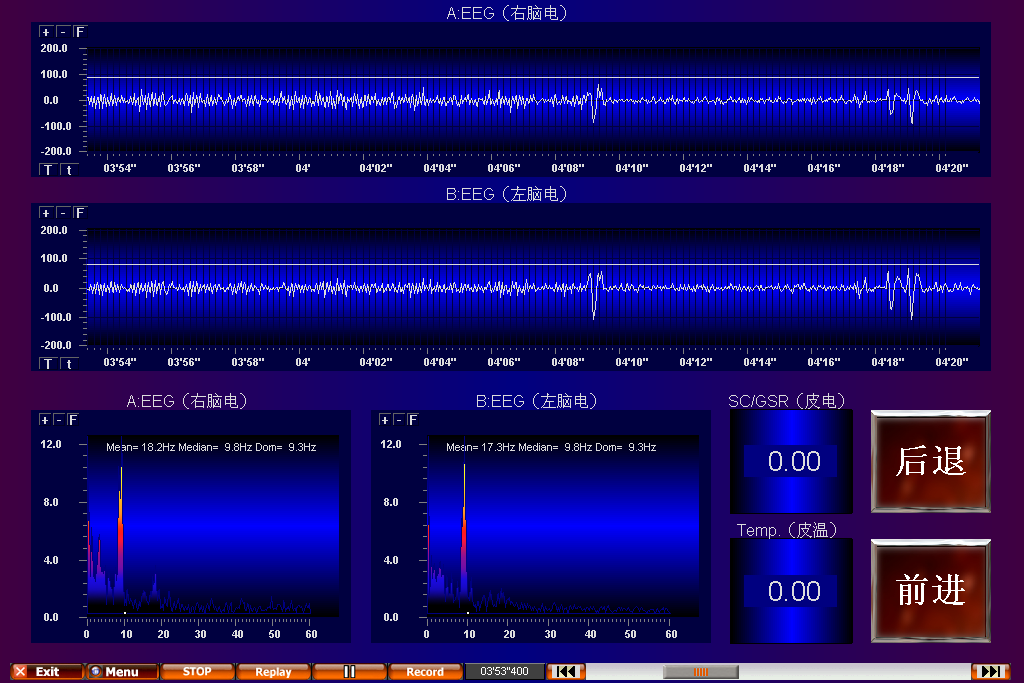 KF0901体感音乐疗法与音乐-电治疗2.png