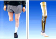 下肢假肢 $24$3.png