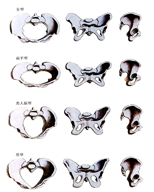 根据骨盆的形状,通常分为女型,男型,类人猿型,扁平型骨盆四种类型