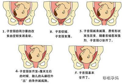 分娩机制的七个步骤图图片