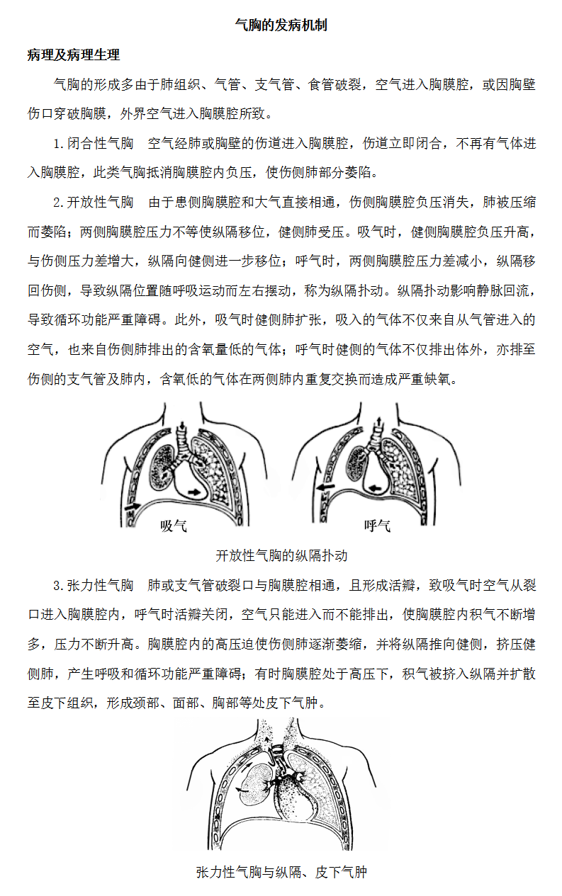 气胸的发病机制