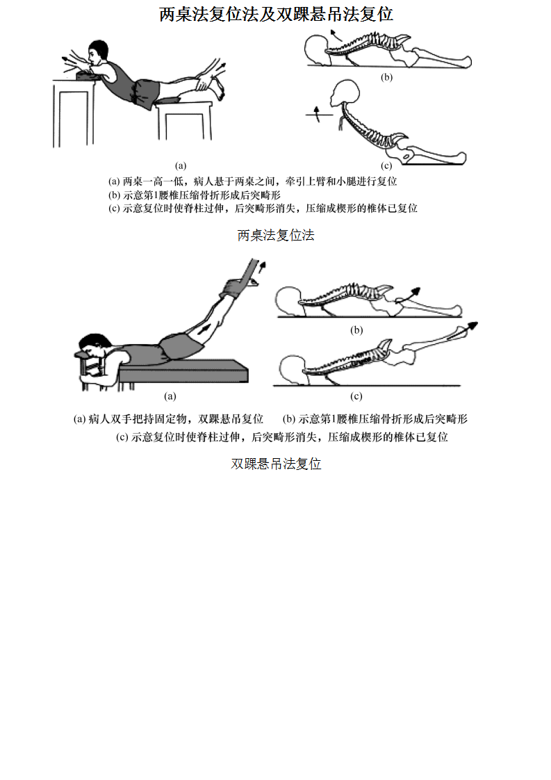 两桌法复位法及双踝悬吊法复位