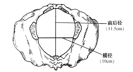 ②中骨盆平面(pelvic midplane):为骨盆最小平面,最狭窄