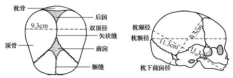 胎头硬生生顶回去图片